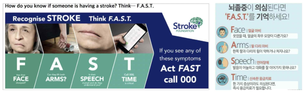 뇌졸중 증상 및 FAST 캠페인 (출처: 호주 stroke foundation, 대한뇌졸중학회)