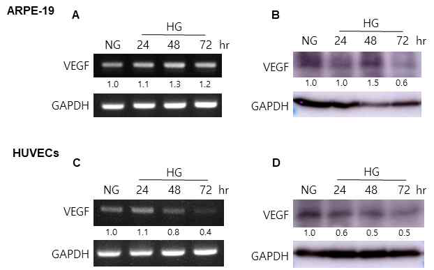 High glucose condition에서 VEGF level 변화 확인