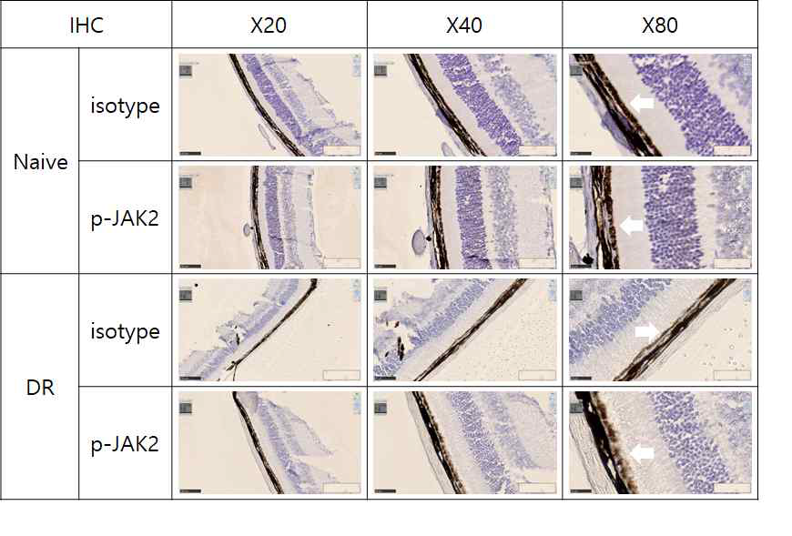 IHC를 통한 JAK2의 활성화 정도 확인