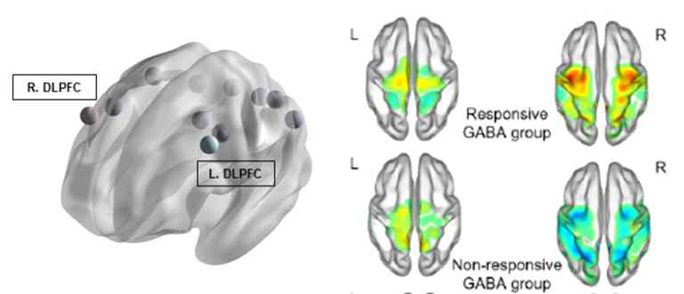 경두개자기자극의 신경 조절 타겟 영역과 경두개 자기자극 후 뇌 내 대사물질-네트워크 예비 분석 결과
