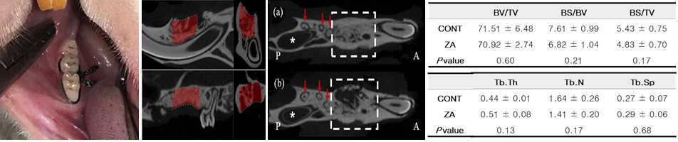 골다공증 유도된 동물모델에서 치주염 유발 및 zoledronic acid투여 후 발치에 의한 악골괴사 모델 평가