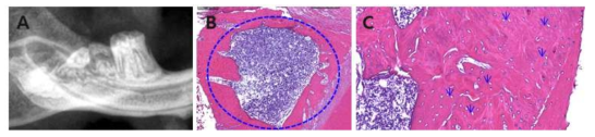 치주염 유발 및 발치 모델. (A) 발치후 plane x-ray; (B) 악골의 inflammatory cells; (C) empty lacuna