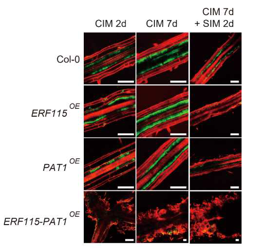 pWOX5::GFP-ER expression in Col (WT), ERF115OE and PAT1OE explants on CIM and SIM. Time points selected for observation are indicated. Cellular outlines were visualized with propidium iodide (PI) staining (red). Scale bars: 100 μm