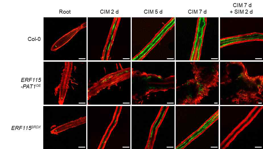 pWOX5::GFP-ER expression in Col (WT), ERF115-PAT1OE and ERF115SRDX explants on CIM and SIM. Time points selected for observation are indicated. Cellular outlines were visualized with propidium iodide (PI) staining (red). Scale bars: 100 μm