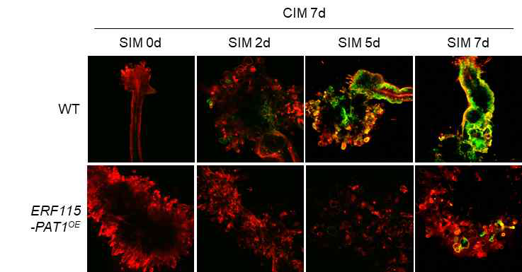 pWOX14::GFP-ER expression in Col (WT) and ERF115-PAT1OE explants on SIM. Time points selected for observation are indicated. Cellular outlines were visualized with propidium iodide (PI) staining (red). Scale bars: 100 μm