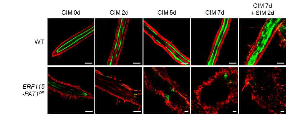 pSCR::GFP-ER expression in Col (WT) and ERF115-PAT1OE explants on CIM and SIM. Time points selected for observation are indicated. Cellular outlines were visualized with propidium iodide (PI) staining (red). Scale bars: 100 μm