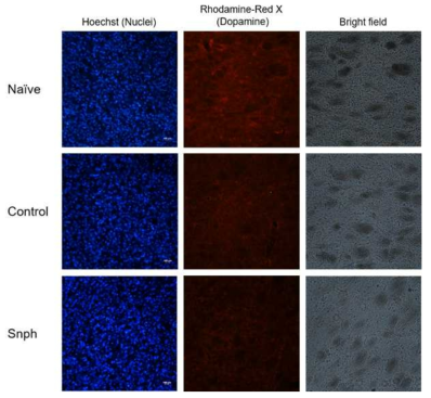 도파민 발현의 비교. Naive, rAAV-Control 그리고 rAAV-Snph 를 주입한 실험동물에서 immunofluorscence (IF) 염색을 하여 각 군에서 도파민의 발현을 비교 확인하였음