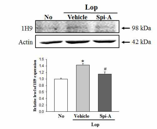 Expression level of 1H9 in IEC-18 after the treatment of spicatoside A