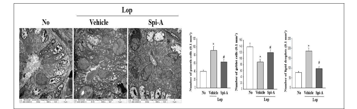 Ultrastructure image of transverse colon from Lop+Spicatoside A treated ICR mices