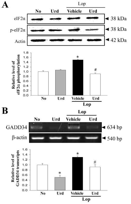 Expression of marker proteins in the PERK/eIF2-ATF4 pathway of ER stress reponse