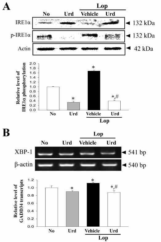 Expression of marker proteins in the IRE1α/XBP pathway of ER stress reponse