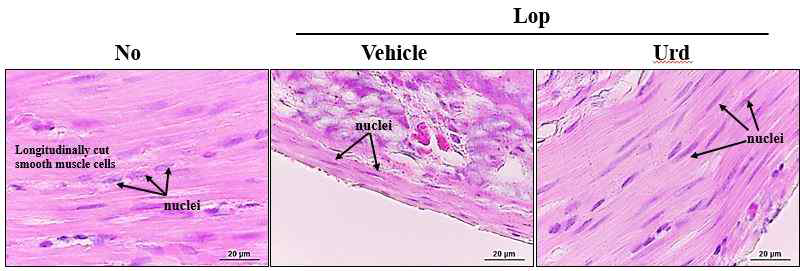 Histological analysis of neuronal cells in transverse colon after the treatment of uridine