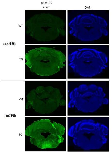 3.5개월령 혹은 10개월령 유래 G2-3 mouse(TG)와 non-carrier littermate mouse(WT)의 뇌를 brainstem 및 cerebellum부위에서 EP1536Y 항체를 이용하여 염색하고, slide scanner를 이용하여 이미지를 얻었음