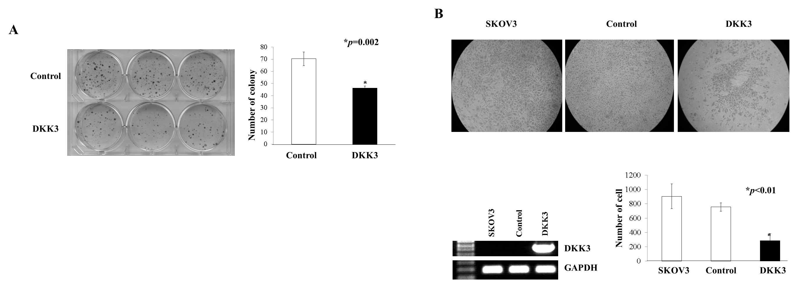 Anti-proliferative and anti-invasive effect of DKK3. (A) Colony formation assay using SKOV3 ovarian cancer cells showed that the colony formation activity of the DKK3-transfected cells was markedly less than that in the control vector-transfected cells (P=0.002). As control vector, pcDNA3.1(-)-DKK3 was used. (B) The invasion capacity of DKK3-expressing SKOV3 cells was less than parental SKOV3 and control vector-transfected SKOV3 cells (P<0.01). The expression of DKK3 was determined by RT-PCR and GAPDH was used as a loading control. These results are representative of three independent experiments