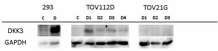 Western blot analysis showed the variable expression of DKK3 in stable cell clones