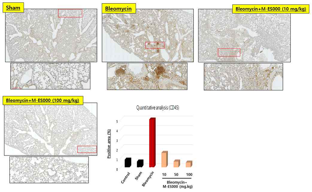 실험동물 폐조직에서 시행한 Masson’s Trichrome 염색 결과