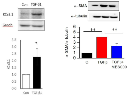 Fibroblast 세포주인 NIH-3T3에서 TGFβ가 KCa3.1 채널과 α-SMA 수준에 미치는 효과. TGFβ는 KCa3.1 채널과 α-SMA 수준을 증가시킴. TGFβ에 의한 α-SMA 수준 증가는 본 연구팀이 개발 중인 섬유화 억제제인 MES000에 의해 유의하게 감소함. 평균(mean)±SE(standard error)로 표기하였으며, n=6. **<0.01