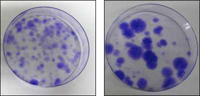 100mm dish에 3000개의 세포를 배양하여 3주간 콜로니 형성능을 평가한 결과. (좌)지방줄기세포의 콜로니 형성 모습. (우) 골수줄기세포의 콜로니 형성 모습