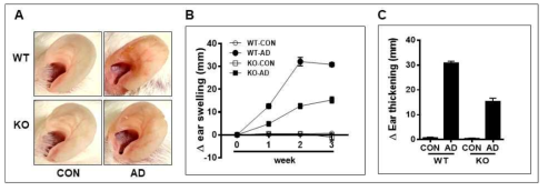 야생형 (WT) 마우스와 CXCL10 유전자가 결손된 마우스 (KO)에서의 아토피피부염 발생 변화. A. 귀사진, B. 유도기간 동안 귀두께변화, C. 21일째 귀두께변화. WT; wild type, KO; Knockout, AD; atopic dermatitis