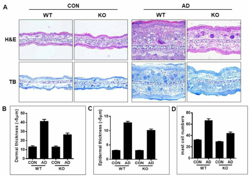 아토피피부염 유도된 야생형과 넉아웃마우스 조직에 대한 조직학적 변화 비교분석. A. 조직염색 사진, B. 진피두께 변화, C. 상피두께 변화, D. 병소조직내 침윤된 비만세포 수 변화. WT; wild type, KO; Knockout, AD; atopic dermatitis, H Hematoxylin  Toluidin blue