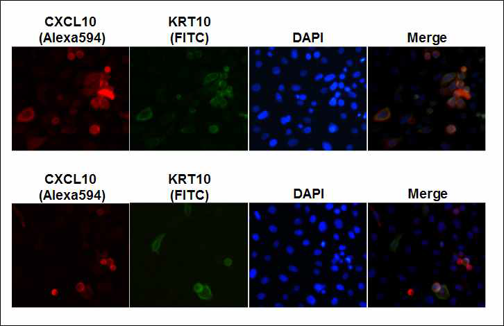 HKC에서 CXCL10, KRT10, KRT14의 발현양상