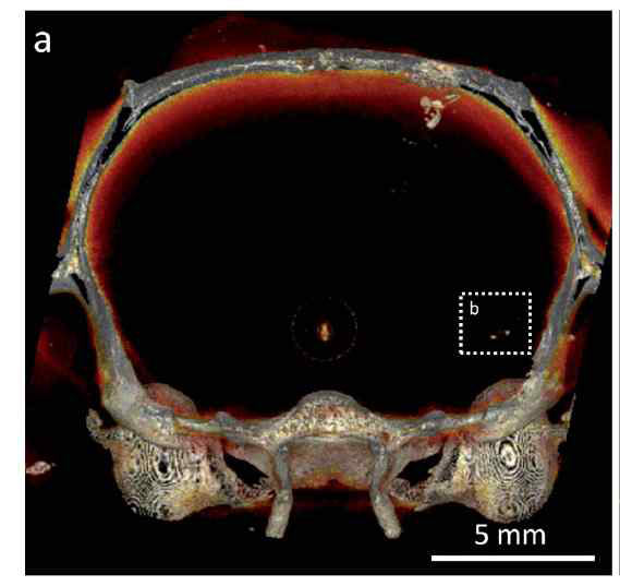 골드입자를 이용한 glioma 세포 추적 영상 (Ex vivo microCT scan of rat head injected with gold nanoparticle labeled glioma
