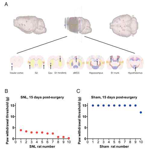 회피 반응 역치와 상관관계를 갖는 뇌 영역 (A) 및 SNL군과 Sham군의 회피 반응 역치 (B와 C)