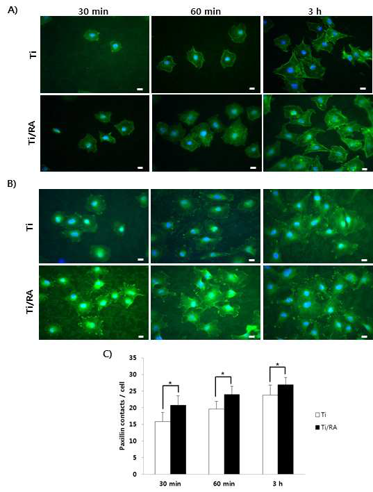 Effect of RA on formation of F-actin and paxillin contacts in MC3T3-E1 preosteoblasts on Ti surface