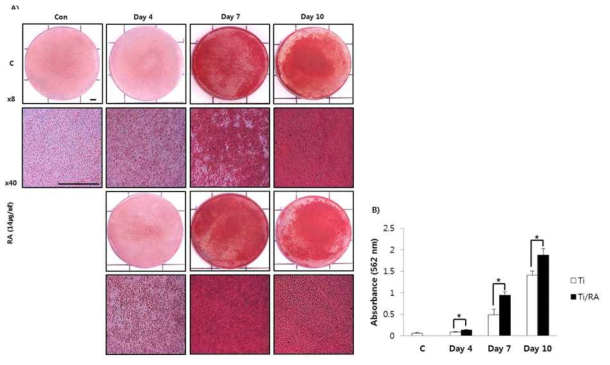 Effect of RA on mineralization through Alizarin Red S staining in MC3T3-E1 cells on Ti surface during differentiation