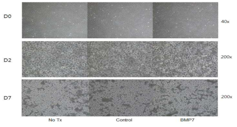 분화 유도 시작일 (D0), 2일째 (D2), 7일째 (D7) 분화 배양액만 처리한 조건 (No Tx), control을 함께 처리한 조건(control), BMP7 1μM을 함께 배양한 조건의 (BMP7) C3H10T1/2 세포