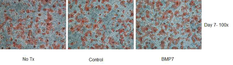 No Tx, control, 3,3nM BMP7 (BMP7)을 분화 유도 전까지 함께 처리하여 분화시킨 지 7일째인 C3H10T1/2 cell의 Oil Red O 염색