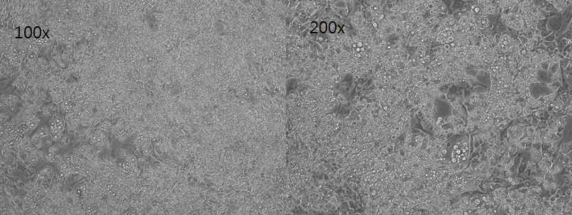 분화 유도 7일째 brown adipocyte cell line