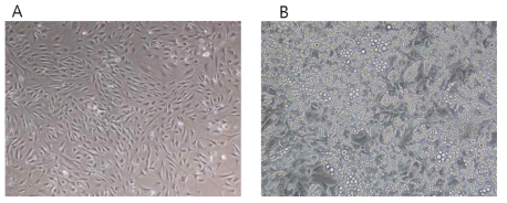 Mouse primary brown adipoctyte 분화 전 D0 (40x) (A)와 분화 7일째 (100x) (B)