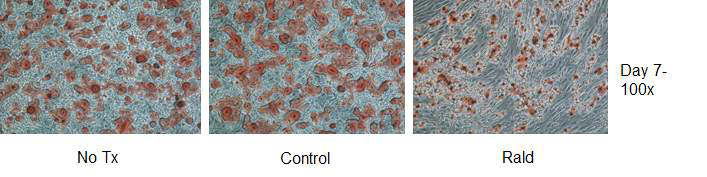 No Tx, DMSO (control), Retinaldehyde 1μM (Rald)을 함께 처리하여 분화시킨지 7일째인 C3H10T1/2 cell의 Oil Red O 염색