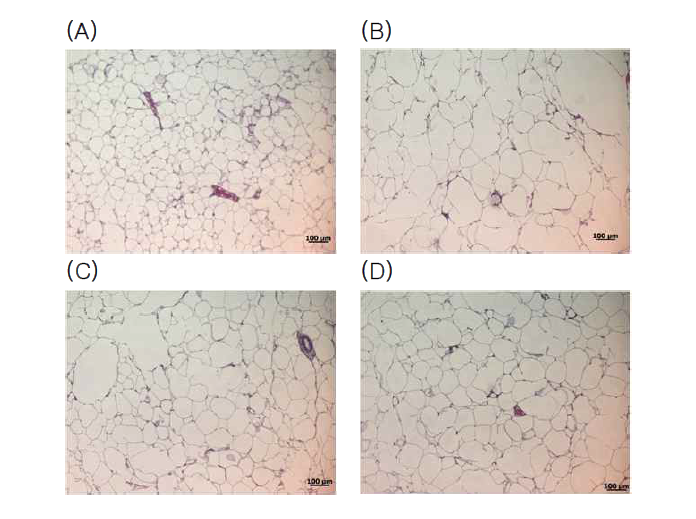 Histological analysis of epididymal tissue (x50) in mice fed with expreimental diets.(A) normal diet, (B) high-fat diet(HFD), (C); HFD + TB, (D) HFD + ATB