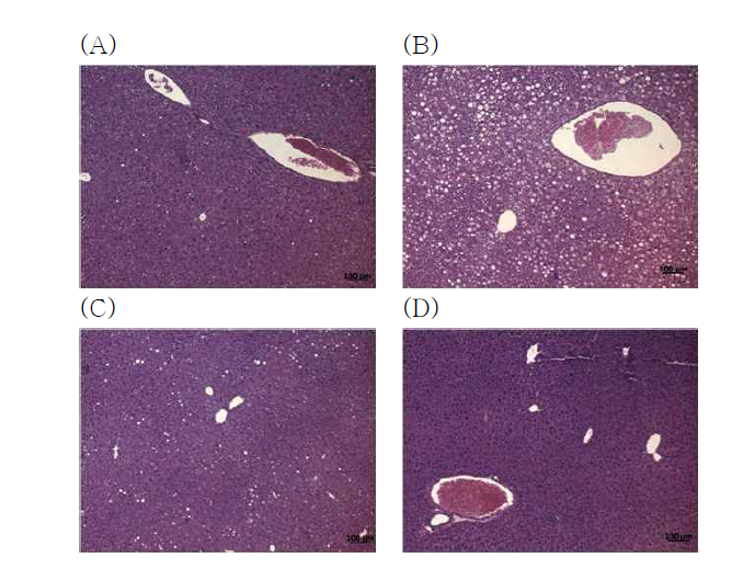 Histological analysis of liver tissue (x50) in mice fed with expreimental diets.(A) normal diet, (B) high-fat diet(HFD), (C); HFD + TB, (D) HFD + ATB