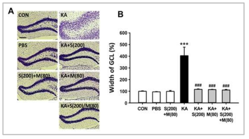 Inhibitory effect of co-treatment with silibinin and morin on the progression of GCD induced by KA in the late stages of epileptogenesis