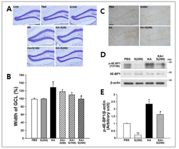 Silibinin attenutes GCD through inhibition of mTORC1 pathway in the hippocampal DG by KA treatment in mice