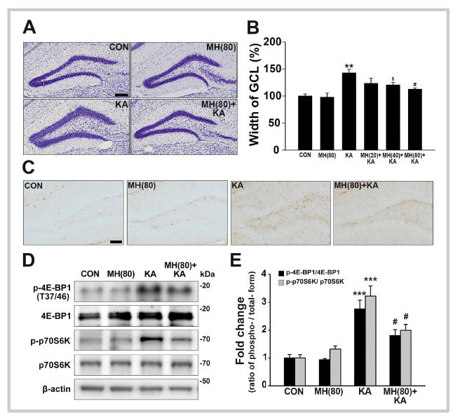 Morin attenutes GCD through inhibition of mTORC1 pathway in the KA-treated DG