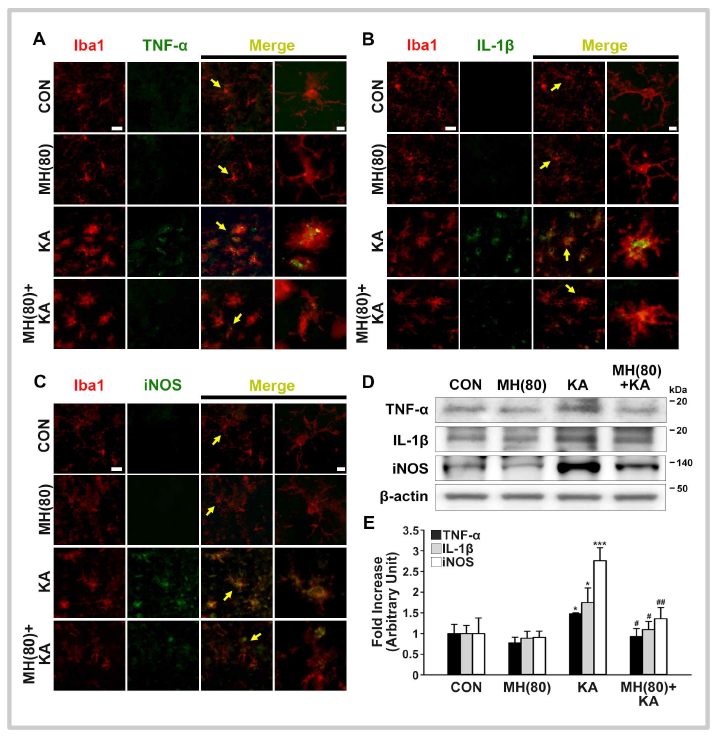 Anti-inflammatory effects of morin in hippocampus of KA-treated mice