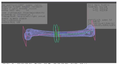 대퇴골의 형태 계측 프로그램 이용 분석