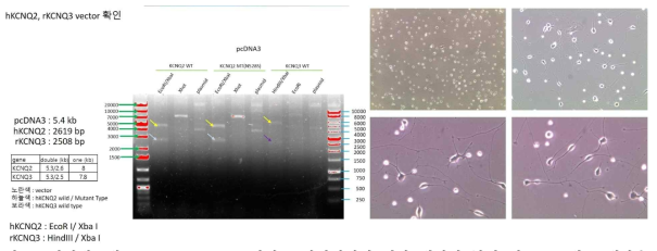 신경세포에 KCNQ2, KCNQ3 변이를 반영시키기 위한 벡터의 확인 및 HT22세포 배양을 통해 시냅스 형성을 확인