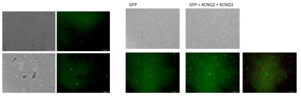 GFP+KCNQ2 c.773A>G, p.N258S vector를 포함한 lipofectamine (왼쪽)과 TransIT-X2(오른쪽)을 이용한 transfection 결과