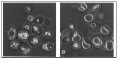 단백질 탈인산화 효소1 돌연변이 세포의 파괴된 소포 구조(좌)와 정상 세포의 소포 융합(우)