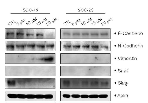 두경부암 세포주에 EGCG 처리 후 EMT 관련 molecule의 변화