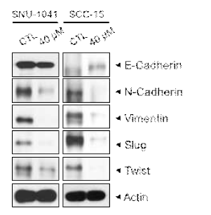 두경부암 세포주에 Curcumin 처리 후 EMT 관련 molecule의 변화