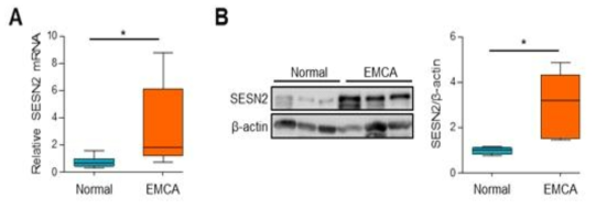 환자의 자궁내막암 조직과 대조군 조직샘플에서 세스트린2의 qPCR 및 Western blot 분석