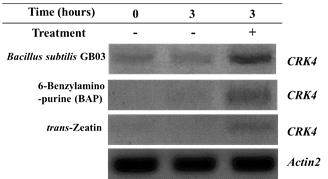 The expression patterns of CRK4 gene in the various conditions
