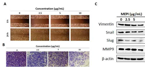 MDA-MB-231 세포에서 MEPI의 전이 억제 효능 연구