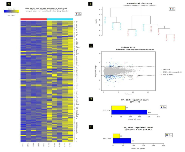 두 그룹간의 Heatmap 발현차이. A. 유의한 gene을 대상으로 hierarchical clustering (distance metric = Euclidean distance, linkage method = complete) 분석을 통해 각 샘플의 gene별 발현 패턴의 유사성 정도를 이용하여 샘플 그룹별, gene별 그룹화된 정보를 시각화하여 나타냄. B. 각 샘플별, normalized 값을 사용하여 샘플끼리 발현 정도의 유사성을 그룹화함. (Distance metric = Euclidean distance, Linkage method= Complete Linkage) C. 정상그룹과 골다공증그룹사이 volume이 높은 순으로 Top 5 ranking gene 을 표시. D. Fold change 기준 up, down별 transcript 개수 E. Fold Change 및 p-value 기준 Up, Down별 Gene 개수